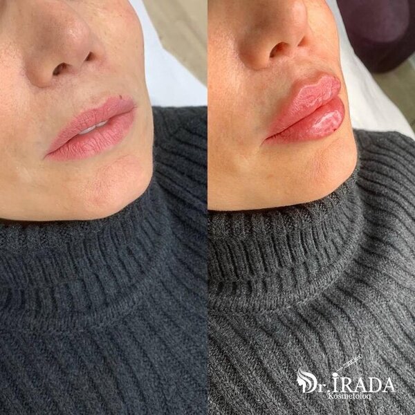 Heç şübhəniz olmasın, gözəlliyiniz etibarlı əllərdədir! - FOTOLAR