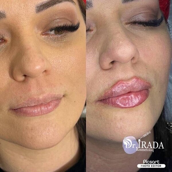 Heç şübhəniz olmasın, gözəlliyiniz etibarlı əllərdədir! - FOTOLAR