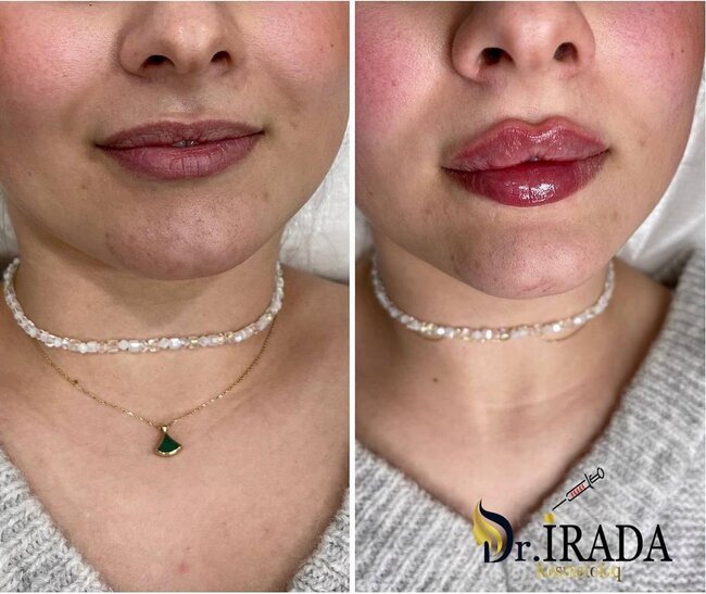 Heç şübhəniz olmasın, gözəlliyiniz etibarlı əllərdədir! - FOTOLAR