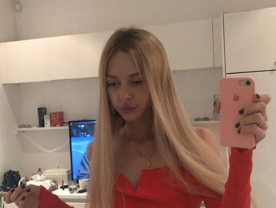 Rusiyalı model anoreksiyadan öldü – FOTO