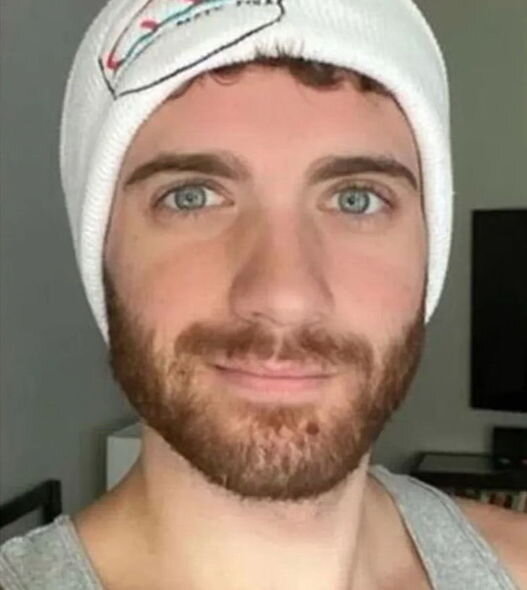 Xəstəlikdən sağalan məşhur aktyor meymunçiçəyi ilə bağlı təcrübəsini bölüşdü - FOTO/VİDEO