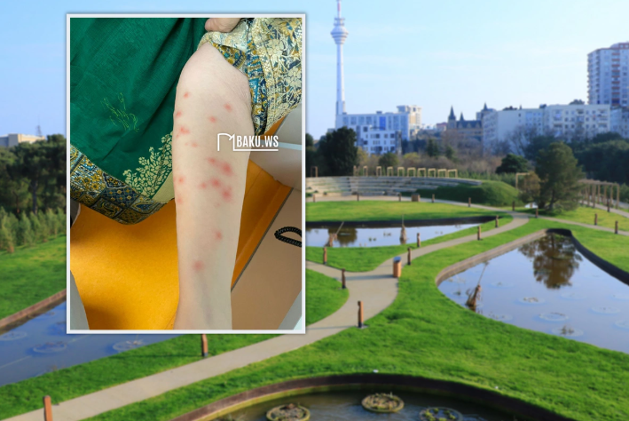 Nəbatat bağından daha bir ŞİKAYƏT: "Bütün gecəni qaşınmışıq..."