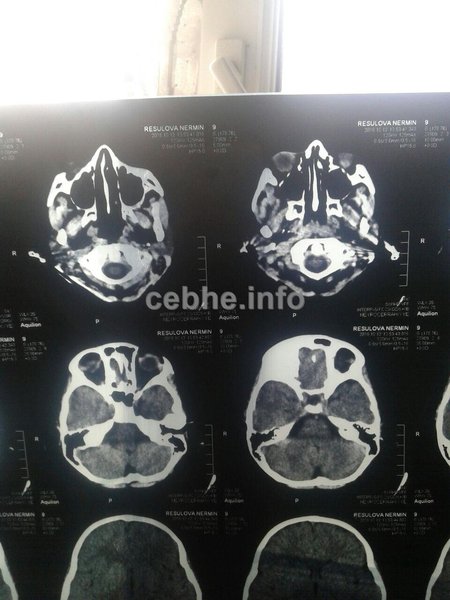 Bakıda ata çarəsizlikdən böyrəyini satır - FOTO