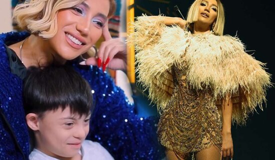 Röya daun sindromlu uşaqlarla görüşdü