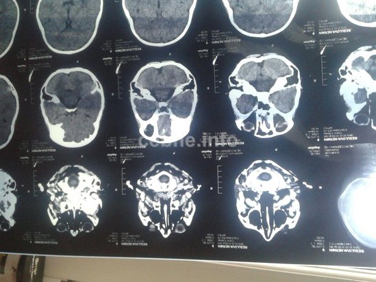 Bakıda ata çarəsizlikdən böyrəyini satır - FOTO