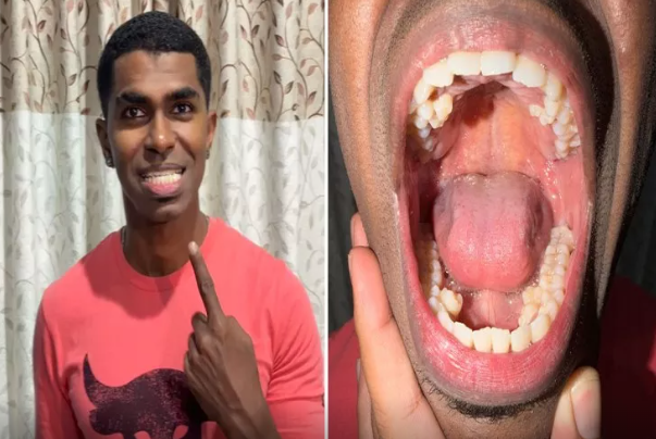 Bu kişinin 42 dişi var: özünəməxsus təbəssümü ilə diqqət çəkir