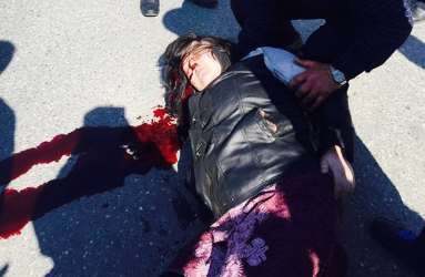 Şabranda dəhşətli qəza! Qadının başı və bədəni bir neçə yerə bölündü