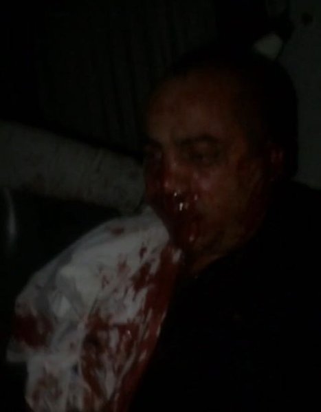 "Lotu Quli"nin adamı -məşhur azərbaycanlı "oğru"nun qulağı kəsildi: DƏHŞƏTLİ FOTOLAR +18