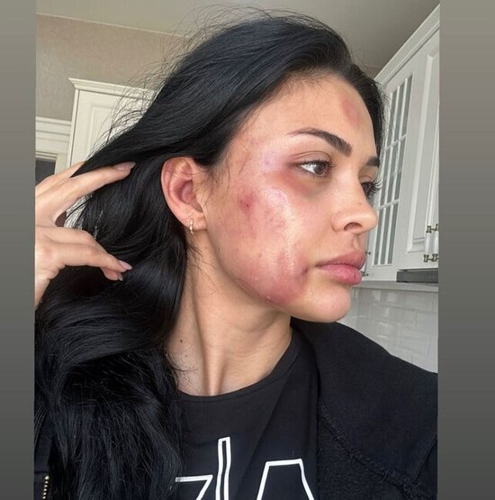 Razinin sevgilisi açıqlama yaydı