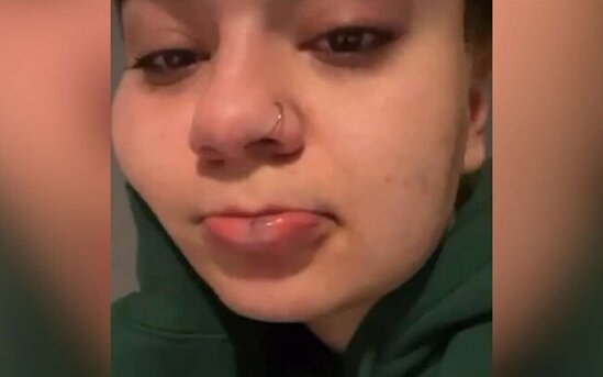 Azərbaycanlı repçi qızını döydü - FOTO