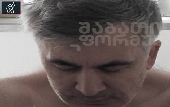 Saakaşvili tanınmaz halda - FOTOLAR