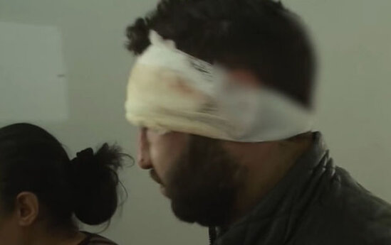 Şəhid bulağının kranını qıran gənci döyüb qulağını kəsdilər - VİDEO