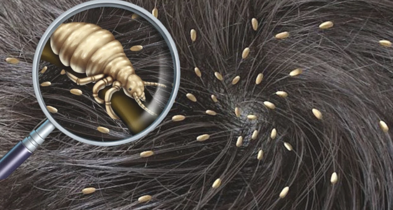 Valideynlərin DİQQƏTİNƏ: Uşaqları niyə yoluxmadan necə QORUYAQ? - VİDEO