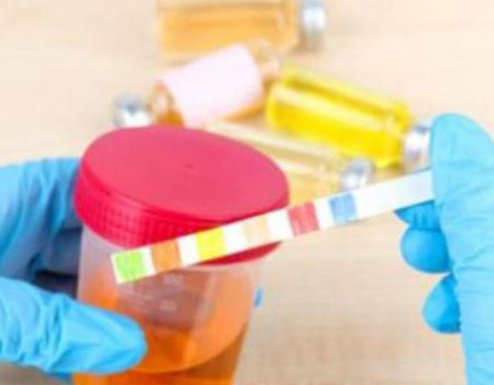 Sidiyin rəngi və qoxusu hansı xəstəliklərdən xəbər verir?