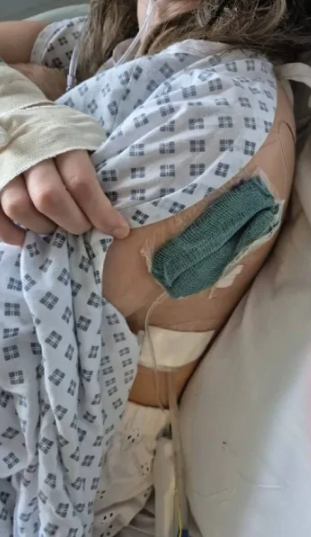 Həftəyə 400-ə yaxın siqaret çəkən 17 yaşlı qız az qala ÖLƏCƏKDİ - FOTOLAR