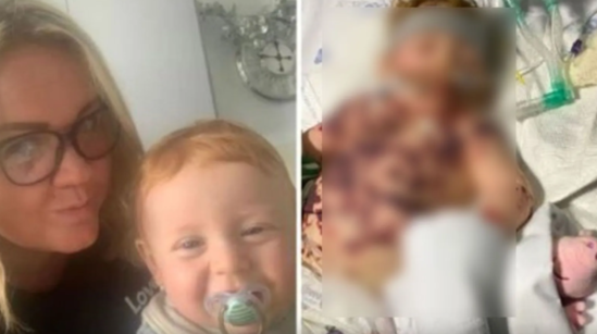 17 aylıq bu uşağın barmaqları kəsilə bilər - FOTO