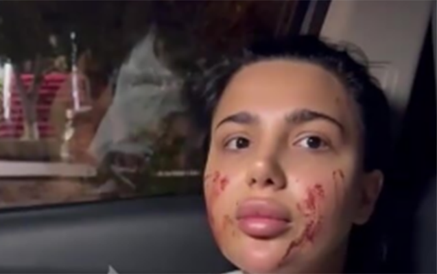 Sabiq məmurun nəvəsi qadına hücum edib? - Video