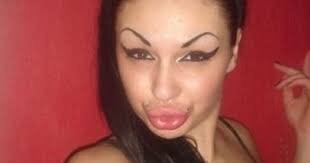 "Silikon": Dəb, yoxsa dərd? - Kosmetoloqdan MƏSLƏHƏTLƏR