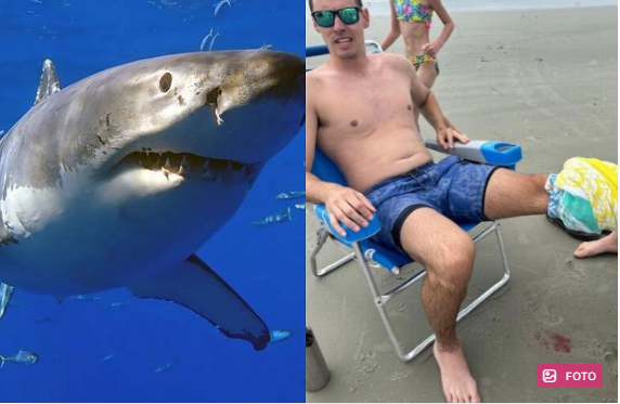 ABŞ-də köpəkbalığı sörfçüyə hücum etdi: Ciddi xəsarət aldı