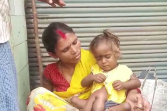 Hindistanda dörd qolu və dörd ayağı olan "hörümçək qız" yaşayır - VİDEO