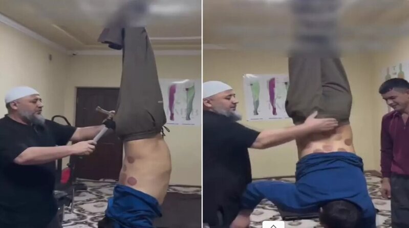 Müalicə yox, işgəncə: Xəstəni ayaqlarından tavana asıb çəkiclə "müalicə etdi" - VİDEO