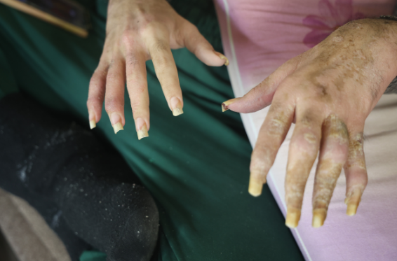 Telefon asılılığı olan gənc: "Əlimdə olsa nə tualetə gedərəm, nə də yemək yeyərəm" - FOTO