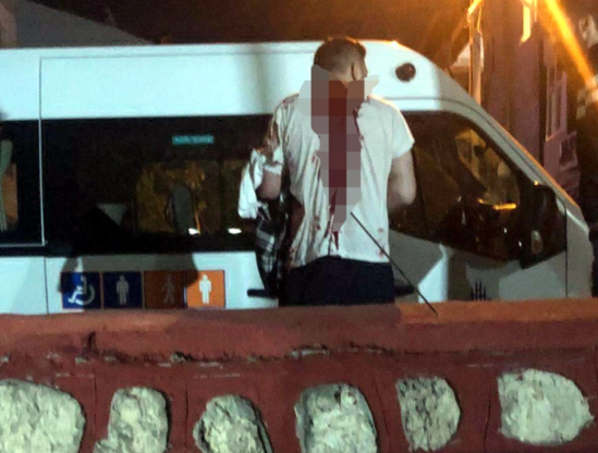 Qardaş qardaşı kəsici ov alətilə kürəyindən vurdu