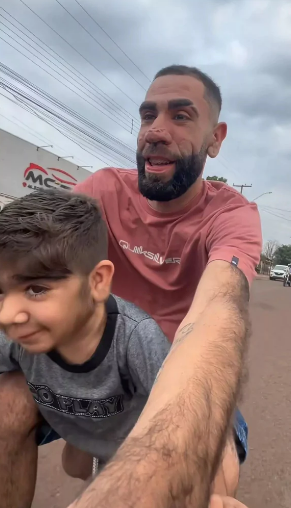 Dünyanın ən tüklü qızının QARDAŞI OLACAQ - FOTOLAR