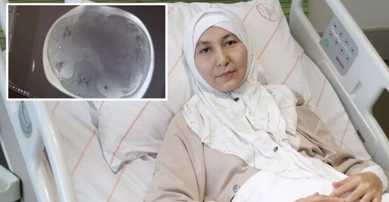 Qadının mədəsindən iki körpə böyüklüyündə şiş çıxarıldı - VİDEO