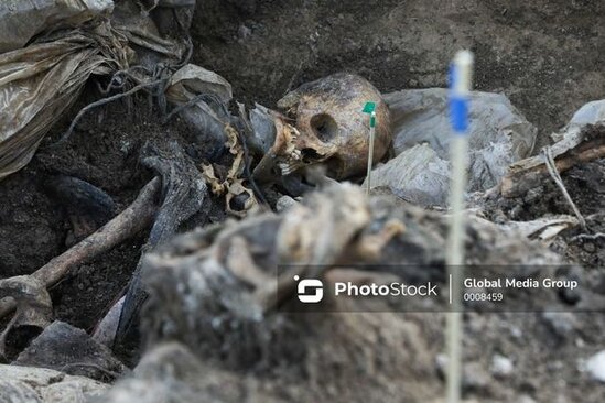 Ağdam və Kəlbəcərdə aşkarlanan sümük qalıqları ekspertizaya gətirilib - RƏSMİ