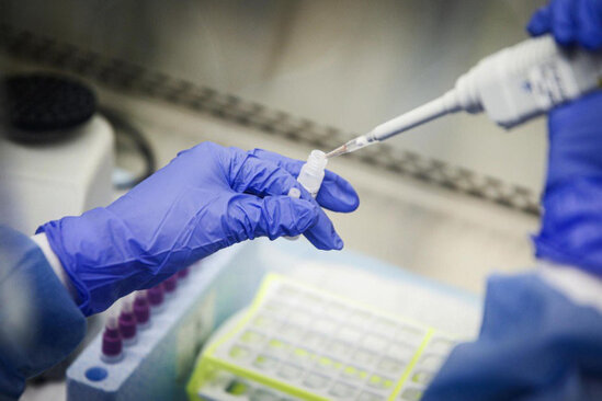 Koronavirusu bloklayan yeni dərman yaradıldı