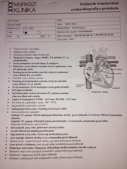 İki dəfə ürək əməliyyatı keçirən körpə Ümüdün atası: "Həkimə aparmağa imkanımız yoxdur" - FOTO