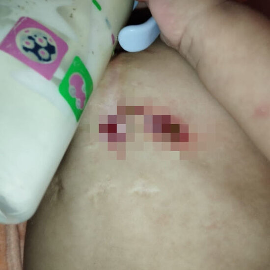 İki dəfə ürək əməliyyatı keçirən körpə Ümüdün atası: "Həkimə aparmağa imkanımız yoxdur" - FOTO