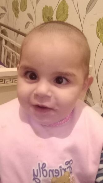 İki dəfə ürək əməliyyatı keçirən körpə Ümüdün atası: "Həkimə aparmağa imkanımız yoxdur" - FOTO