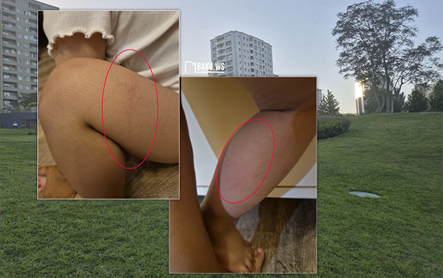 "Mərkəzi Park"da 2 yaşlı uşaq kanalizasiya quyusuna düşdü - Fotolar - Yenilənib