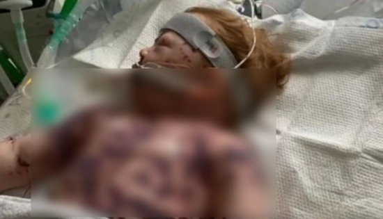 17 aylıq bu uşağın barmaqları kəsilə bilər - FOTO