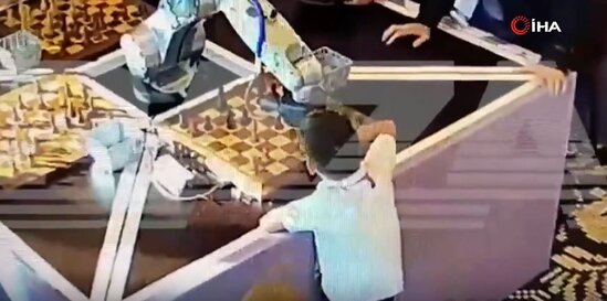 Robot uşağın barmağını belə yaraladı-VİDEO