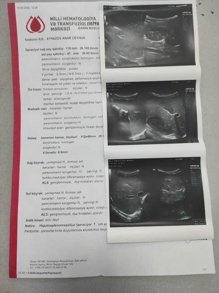 Altı yaşlı Anara kömək edək - FOTO