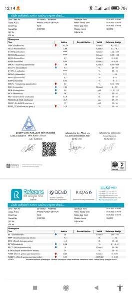 Altı yaşlı Anara kömək edək - FOTO