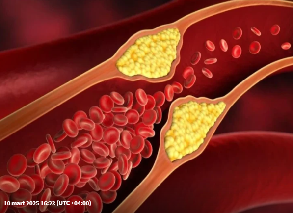 Yüksək xolesterini azaltmaq üçün ən yaxşı meyvə