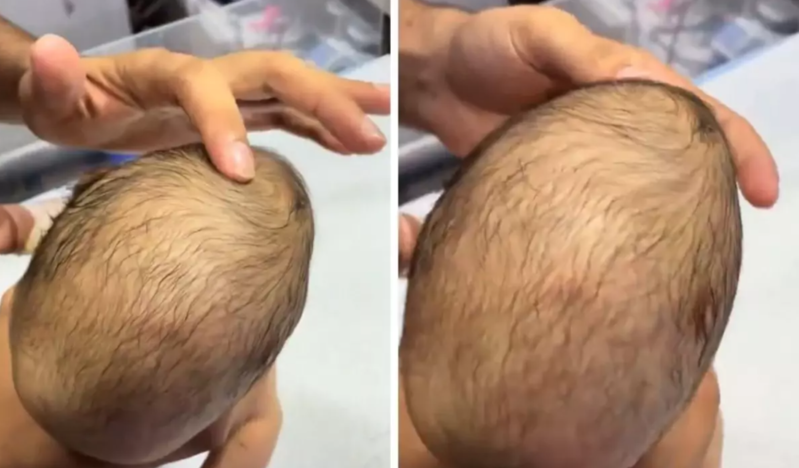 Yeni doğulmuş körpənin başına toxunan həkim şok oldu – VİDEO