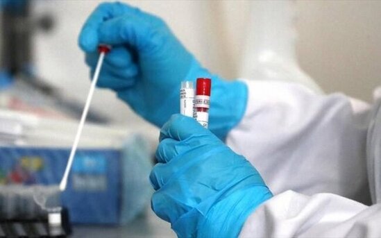 Yoluxmanın artması ilə bağlı əhaliyə çağırış