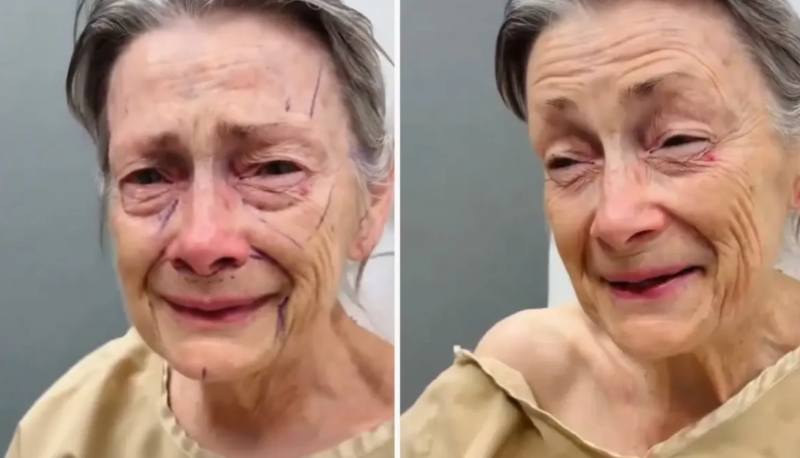 Yaşlı qadının estetik əməliyyatlardan sonrakı dəyişikliyi görənləri şok edir - VİDEO