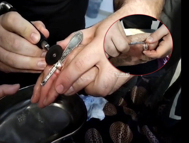 Bakıda barmağına üzük sıxışan yaşlı qadının köməyinə FHN çatdı - VİDEO